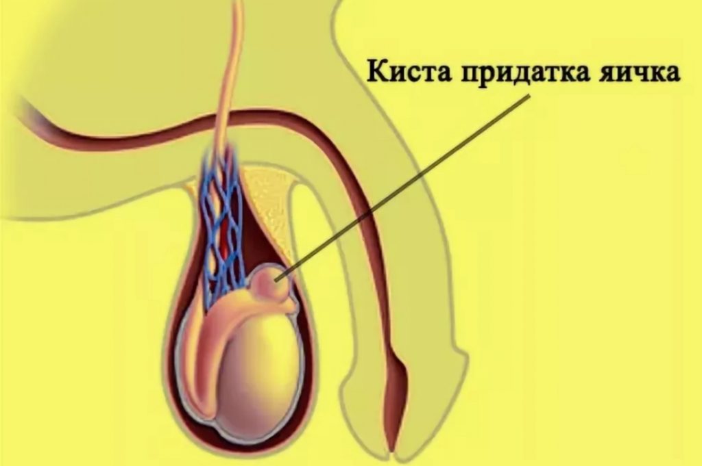 Денервация головки полового члена при преждевременной эякуляции